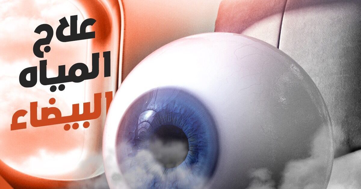 دليل المياه البيضاء | د. محمود حسان